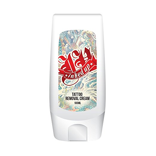 Inked Up Tattoo Removal