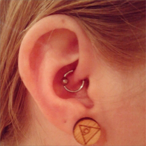 Daith Piercing Ring