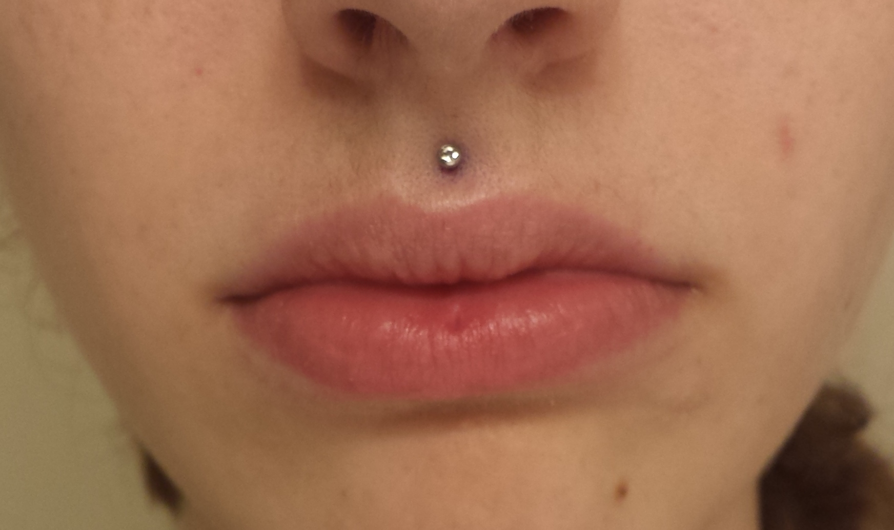 Philtrum or Medusa Piercing